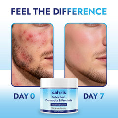 Calvris balm applied to scalp during soothing massage