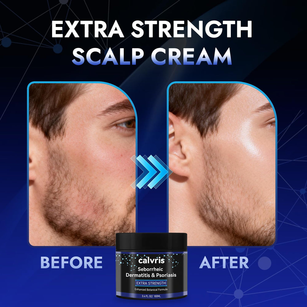 Calvris scalp cream lightweight absorption ideal for daily routines.
