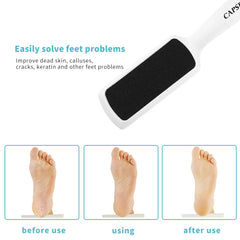 Capspace pack of four foot files white and blue for versatile home pedicures.
