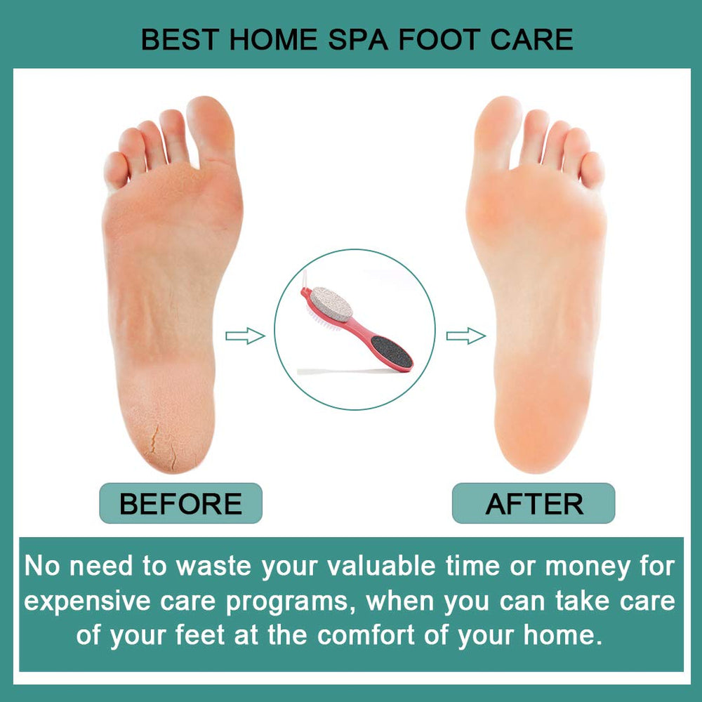 CAREHOOD compact home pedicure set ideal for easy foot care routines.