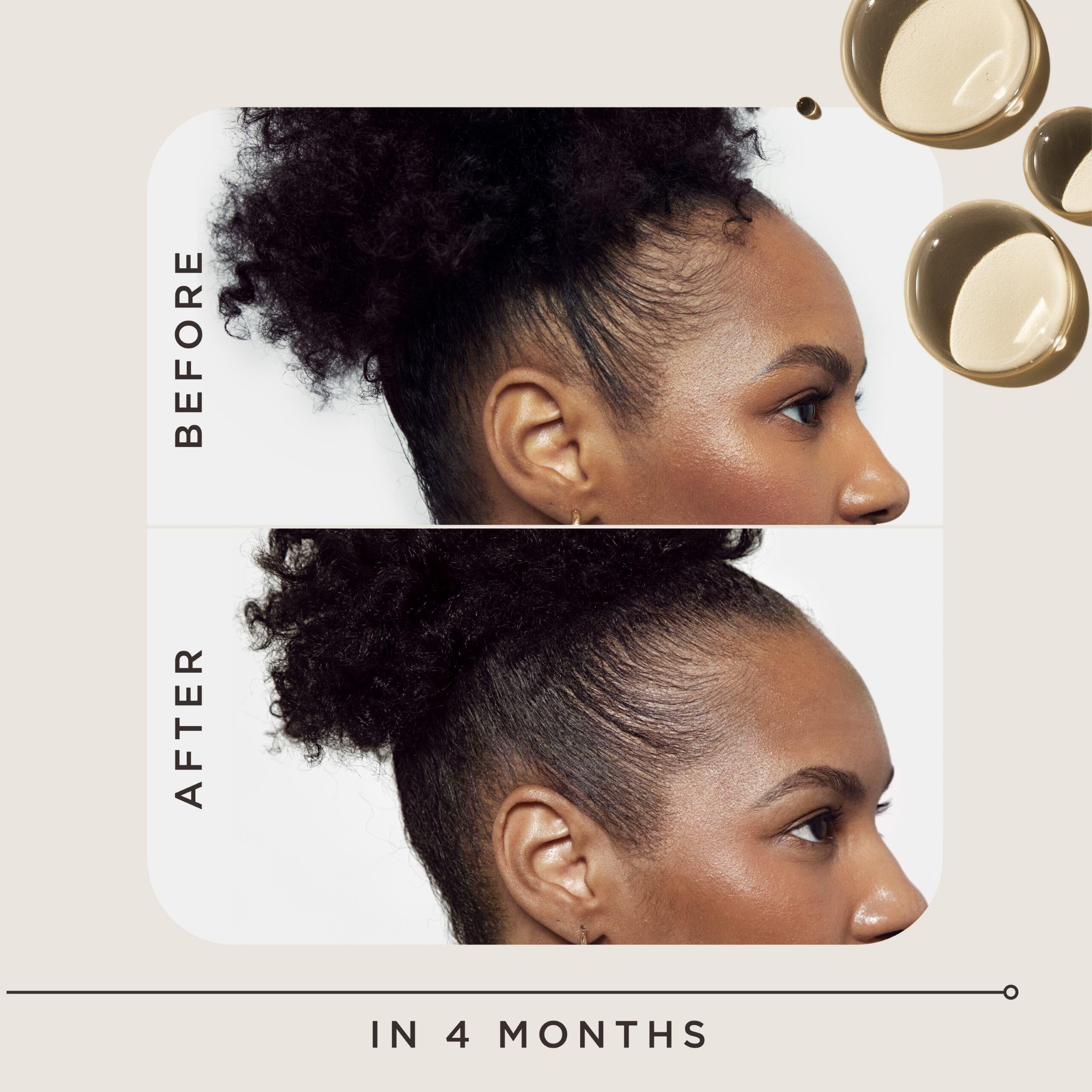 Scalp application scene promoting fuller-looking hair