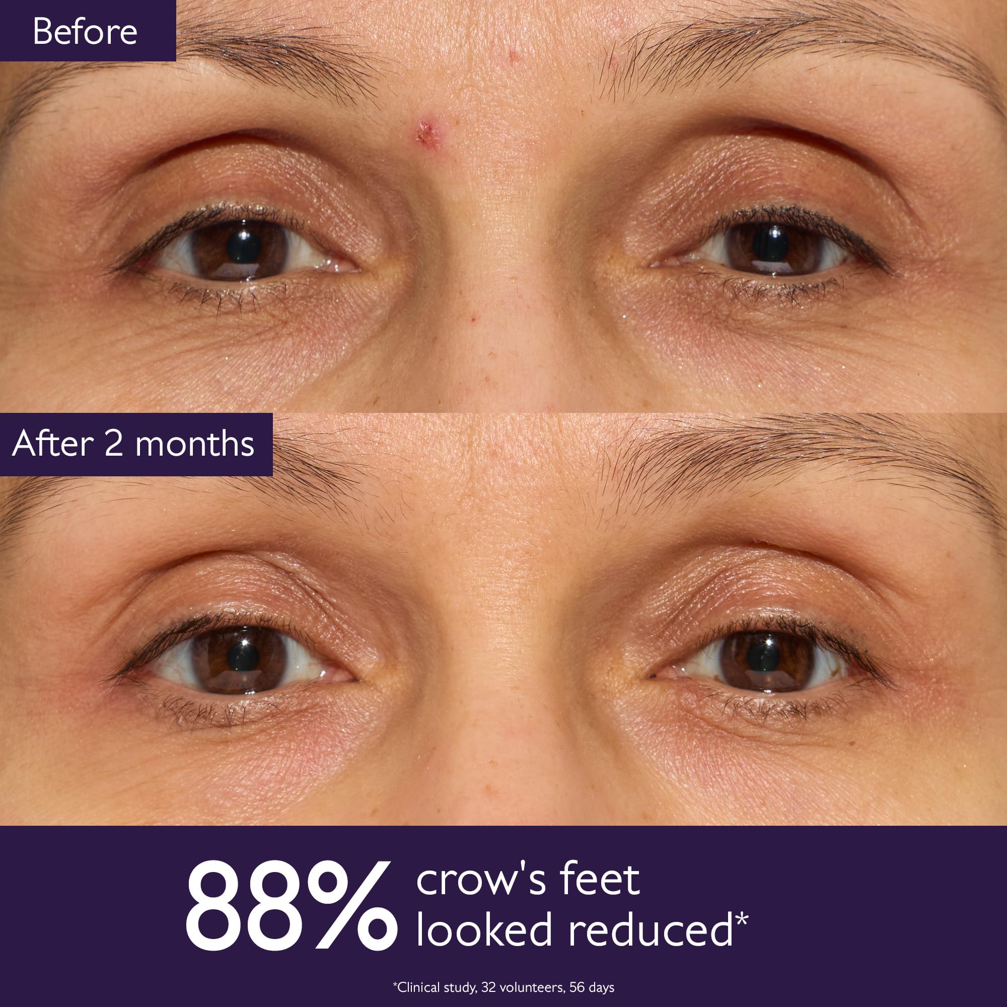 Caudalie Premier Cru eye cream application using cooling metal applicator to depuff