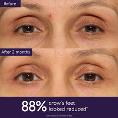 Caudalie Premier Cru eye cream application using cooling metal applicator to depuff