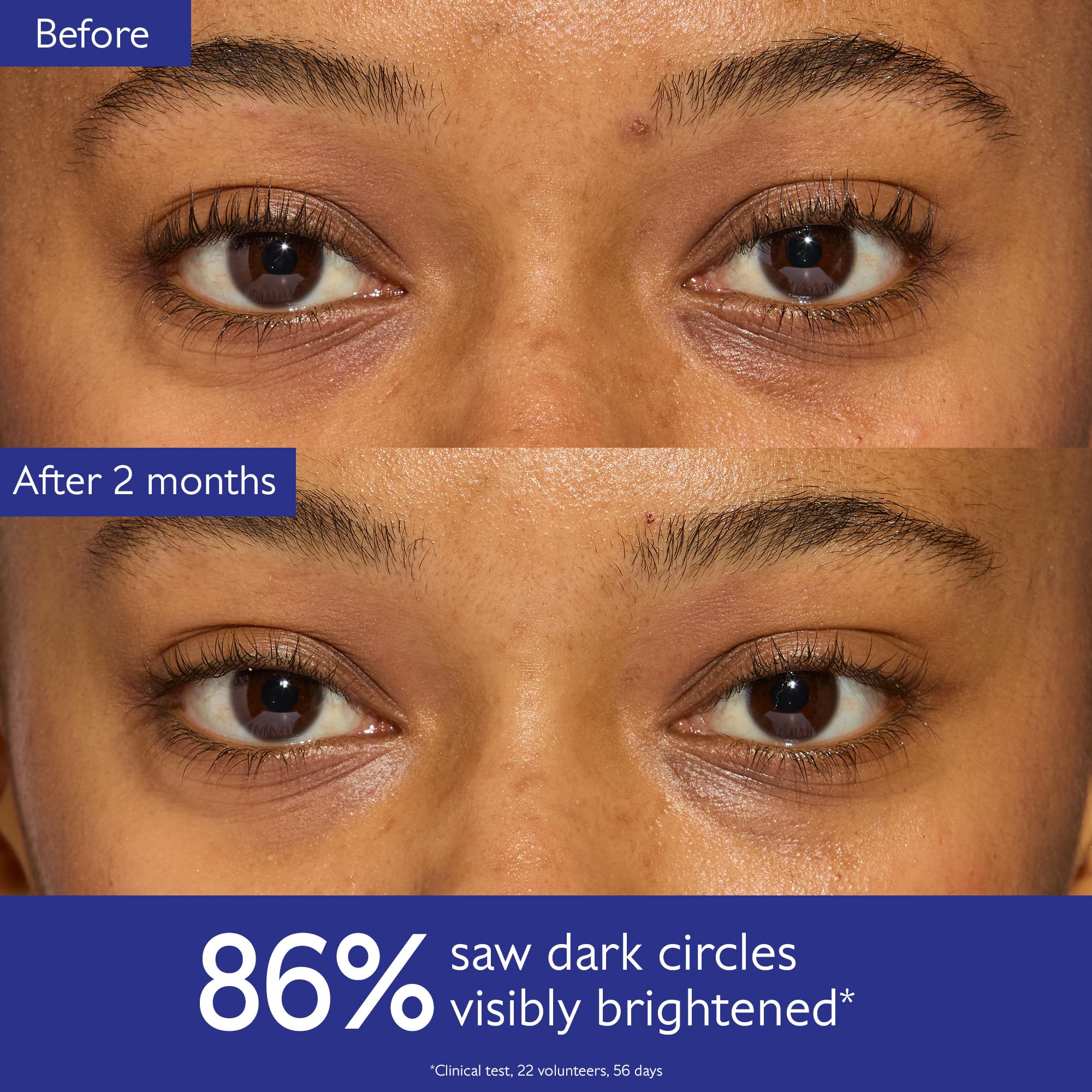 Caudalie Vinoperfect caffeine depuff closeup for energizing eye care.