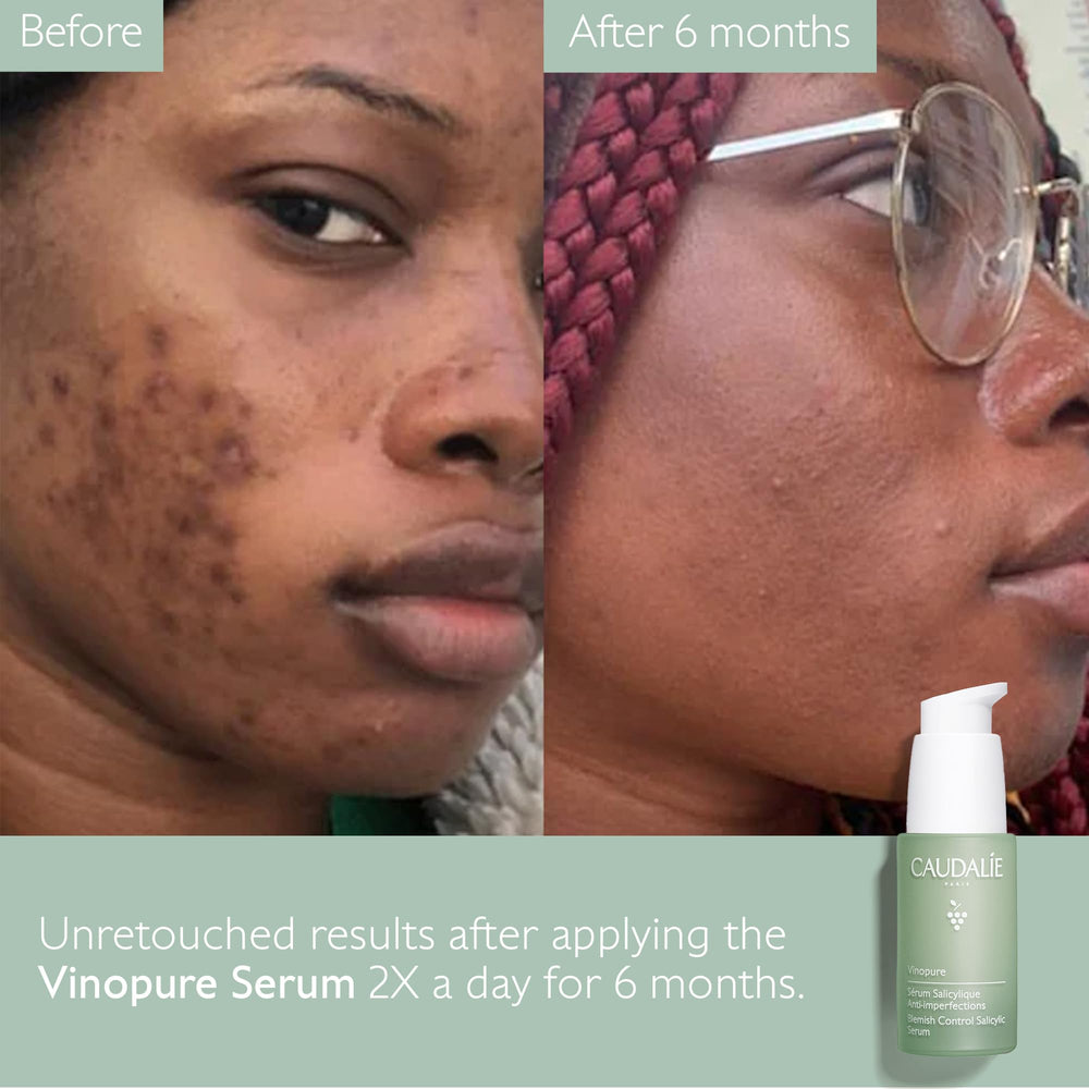 Caudalie Vinopure packaging detail highlights labeling and clean formulation messaging.