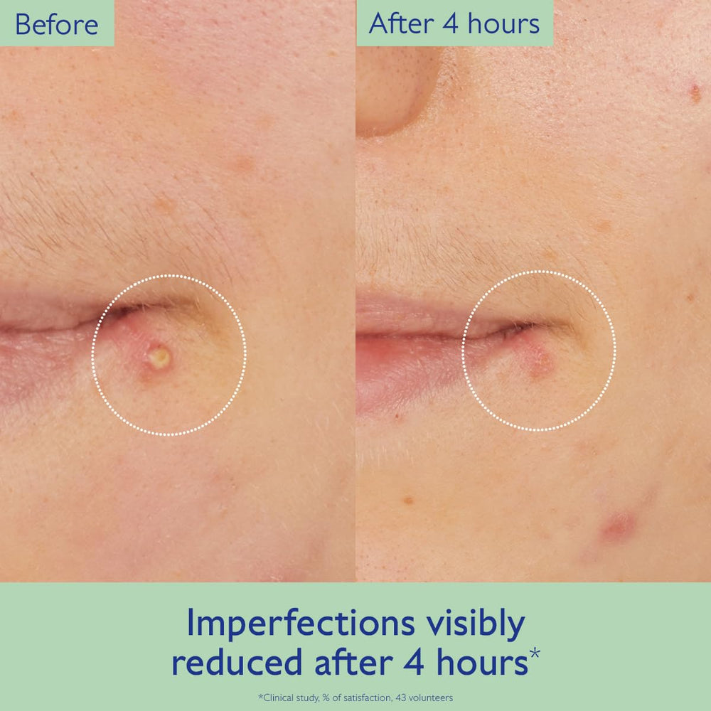 Caudalie Vinopure salicylic acid detail highlighting exfoliant action.