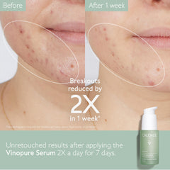 Caudalie Vinopure serum applied to face demonstrates quick absorption before moisturizer.