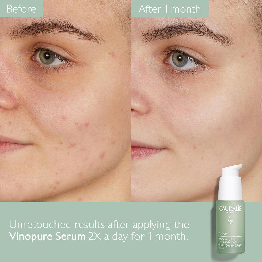 Caudalie Vinopure serum niacinamide boost aids texture evenness and pore appearance.