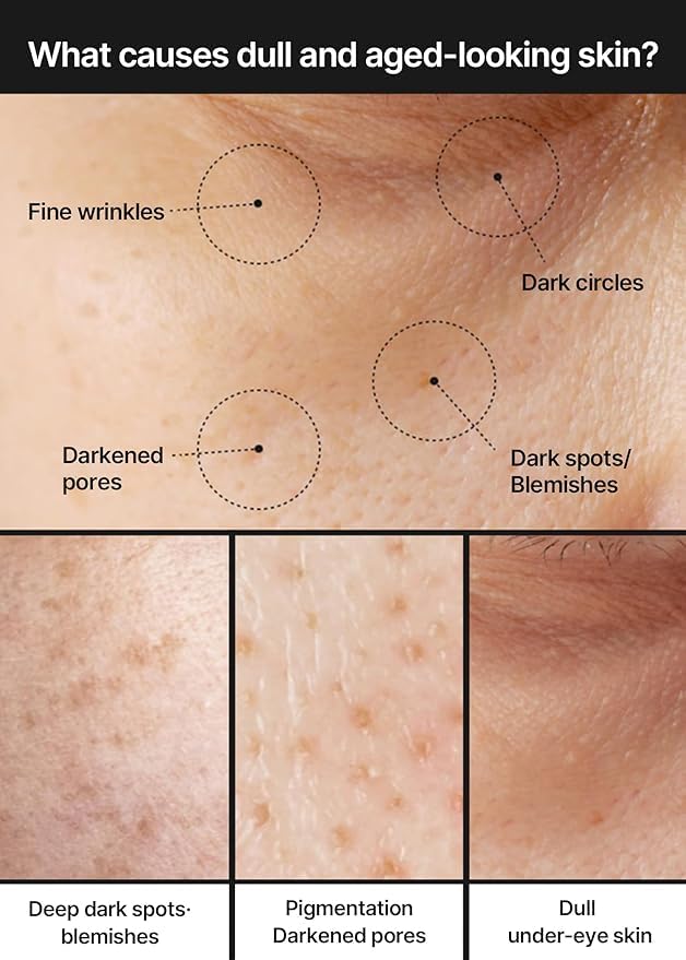 Celimax PorePlus ingredientes clave con niacinamida para cuidado de poros.