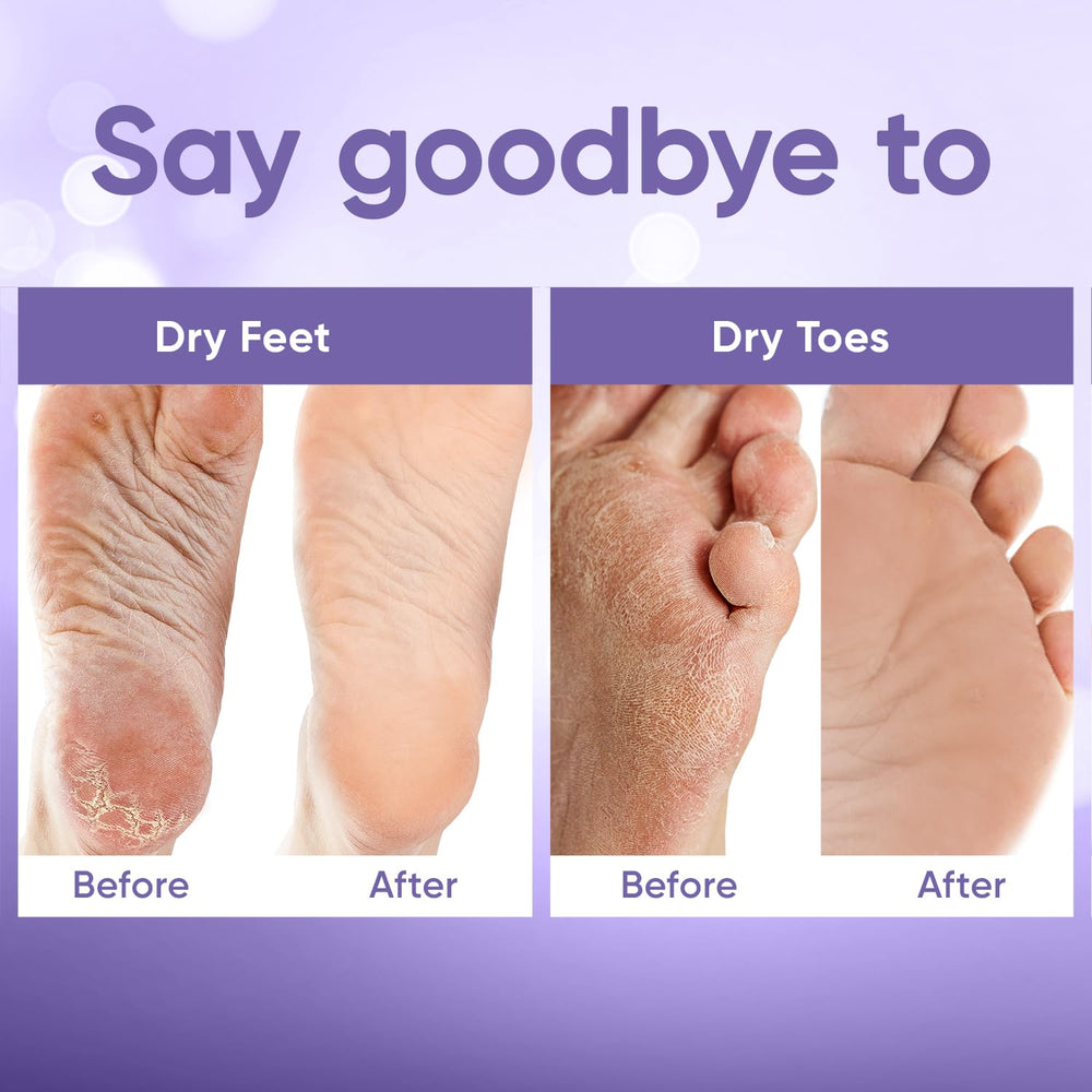 CÉLOR Foot Peel Mask, apto para hombres y mujeres, ajuste cómodo.