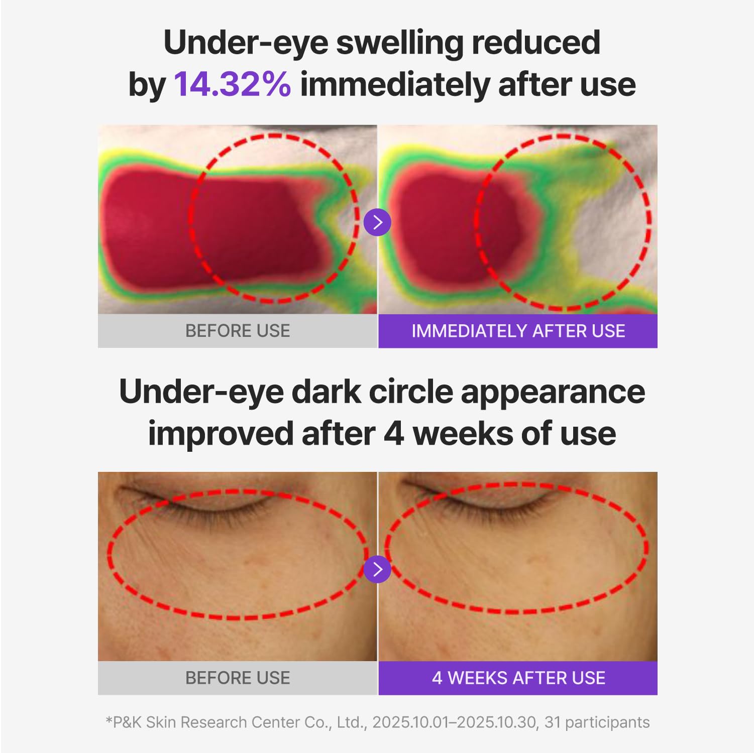 Patch placed under eye for subtle lifting and even tone improvement
