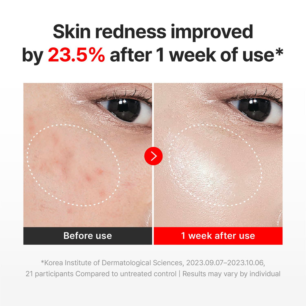 Application massage of Centellian 24 Madeca Cream Time Reverse on the face