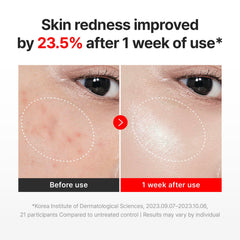 Application massage of Centellian 24 Madeca Cream Time Reverse on the face