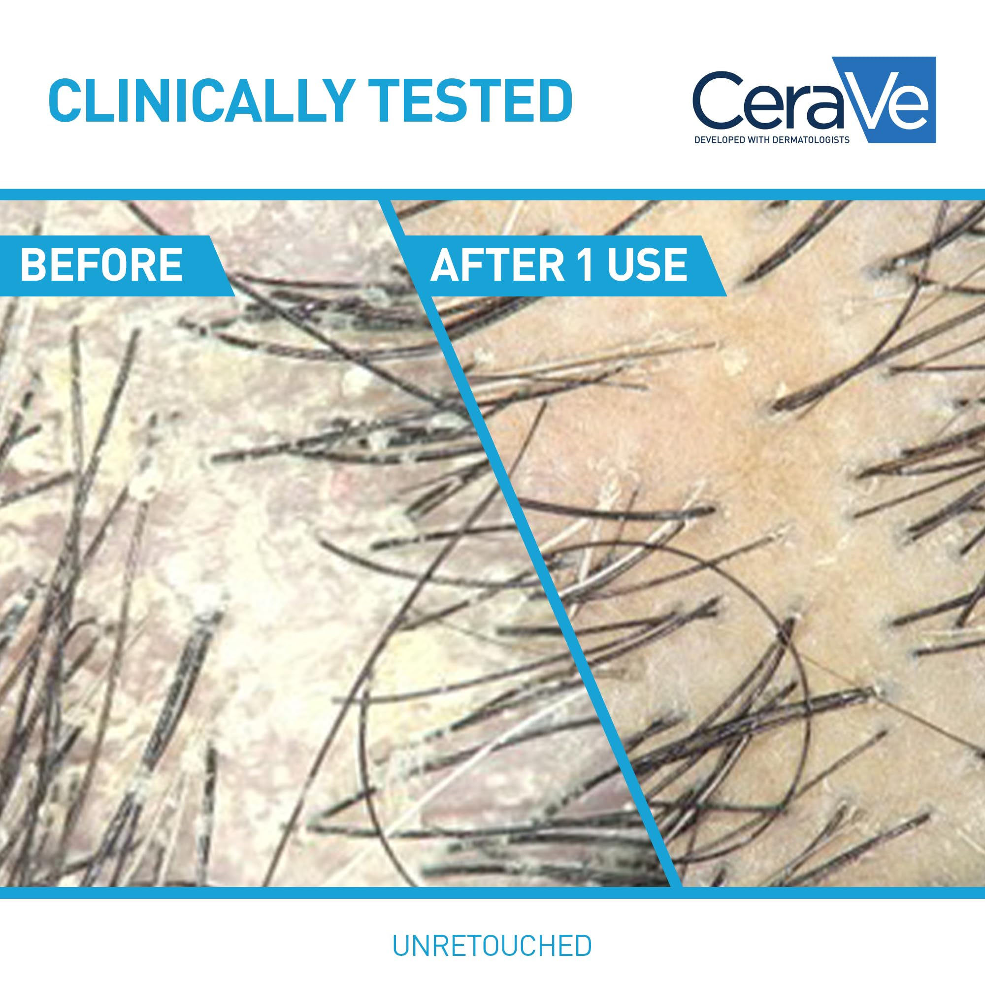CeraVe label closeup highlights 0.5% Pyrithione Zinc for dandruff care.
