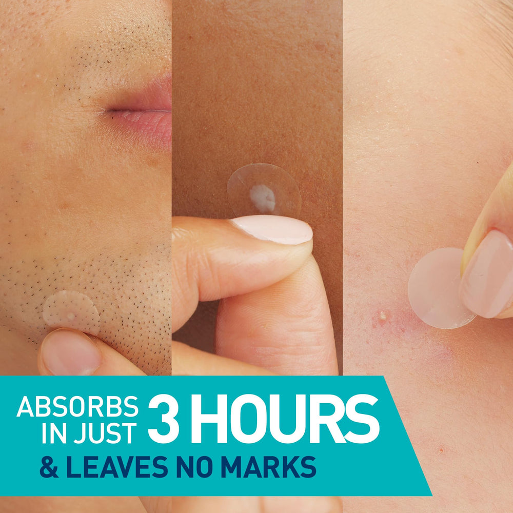 Close-up of CeraVe patches on skin showing invisible wear on all skin tones