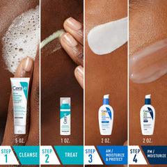 CeraVe Resurfacing Retinol Serum in encapsulated bottle targets post-acne texture