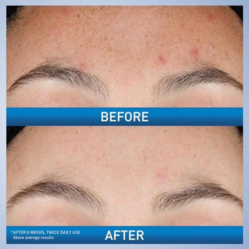 CeraVe Resurfacing Retinol Serum muestra textura ligera de rápida absorción para rostro.