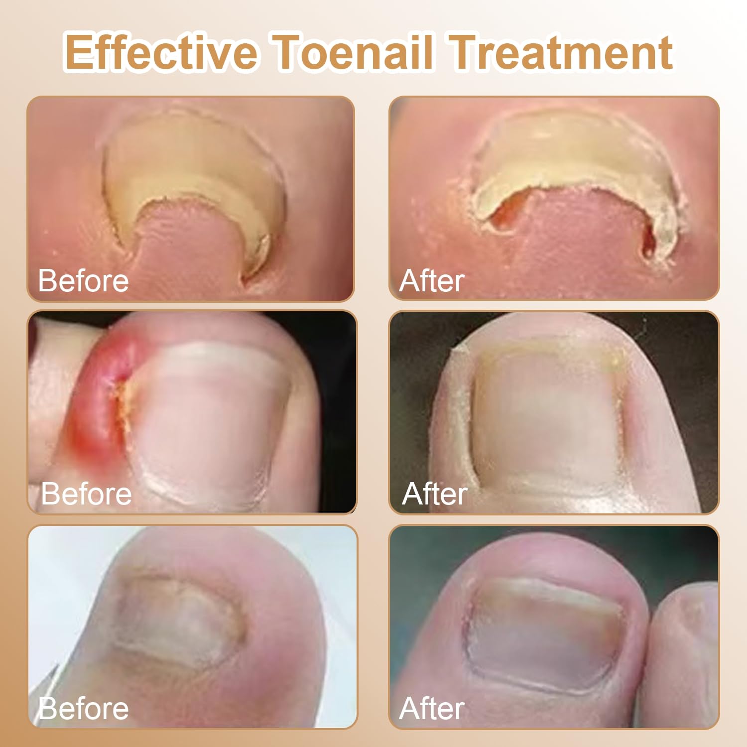 CESWEIAR at home pedicure session with tools and patches