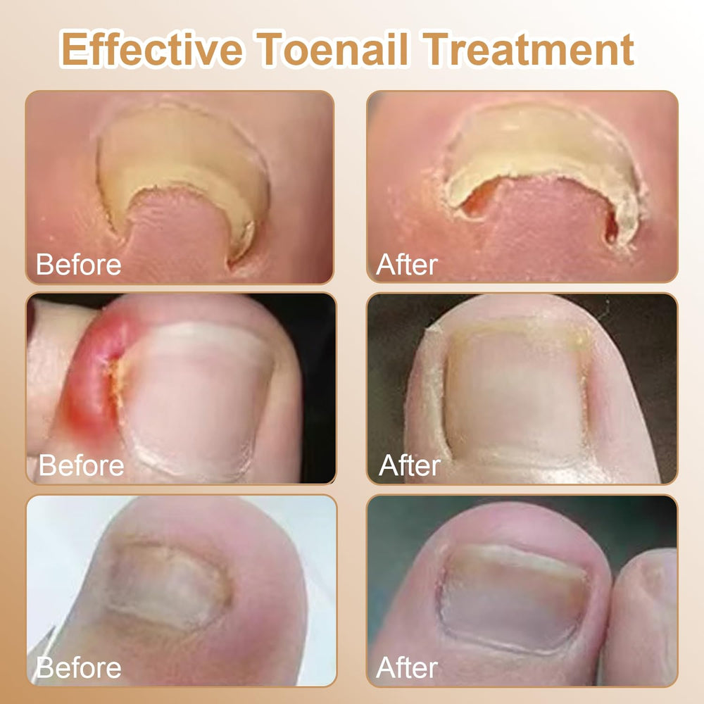 CESWEIAR at home pedicure session with tools and patches