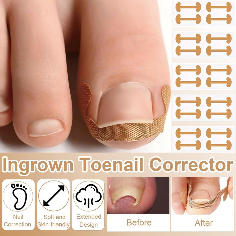 CESWEIAR patches supporting nail growth while reducing pressure on the edge