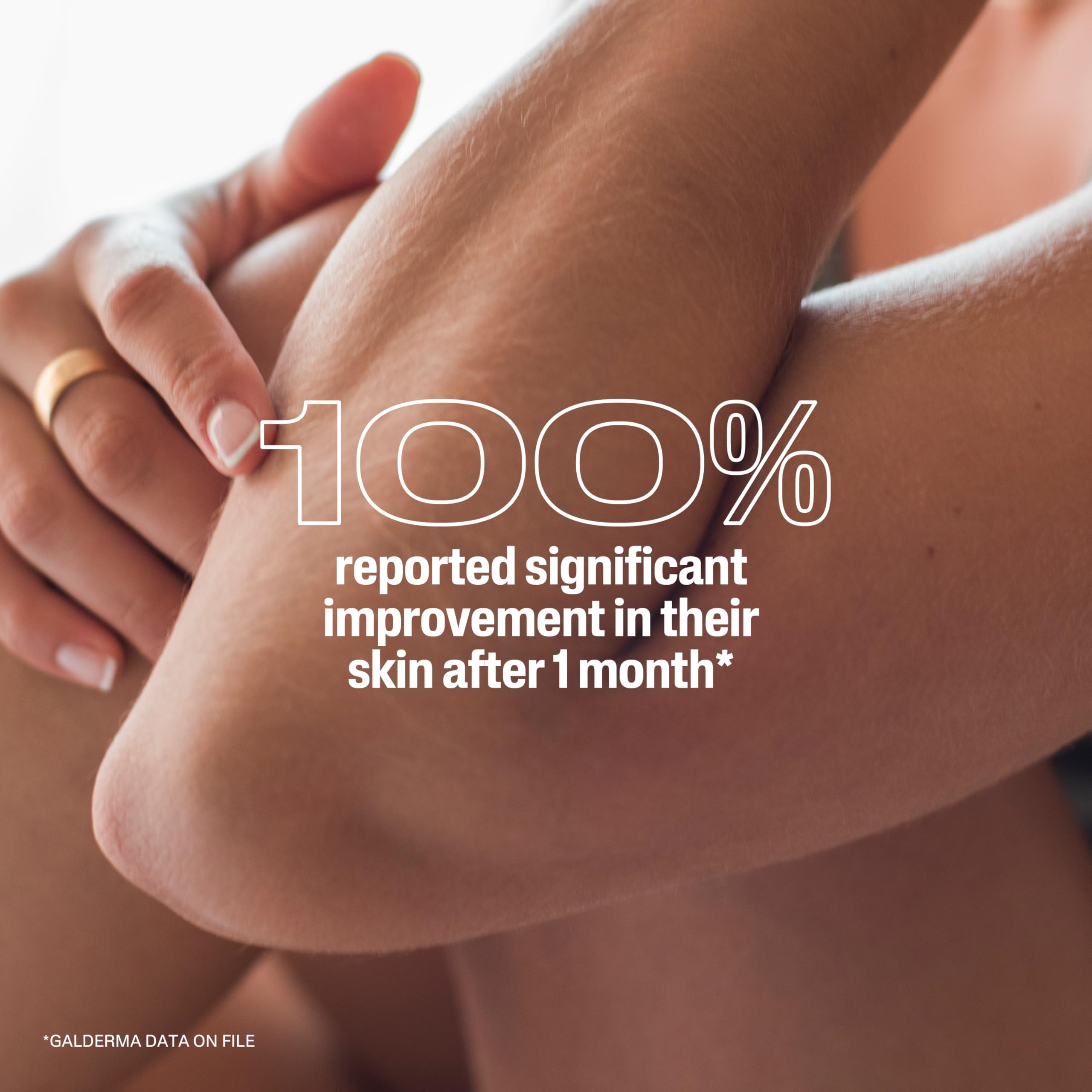 Cetaphil Aplicar en codos ayuda a suavizar zonas secas