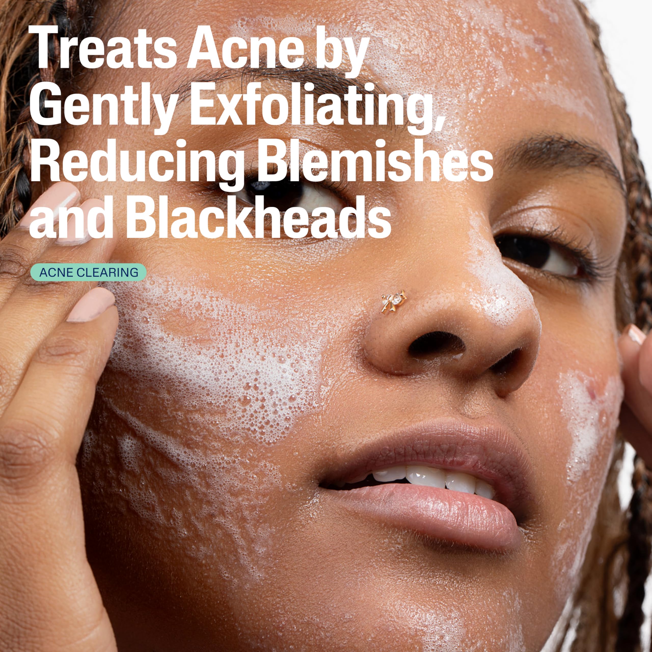 Cetaphil Gentle Clear: ácido salicílico al 2% para imperfecciones