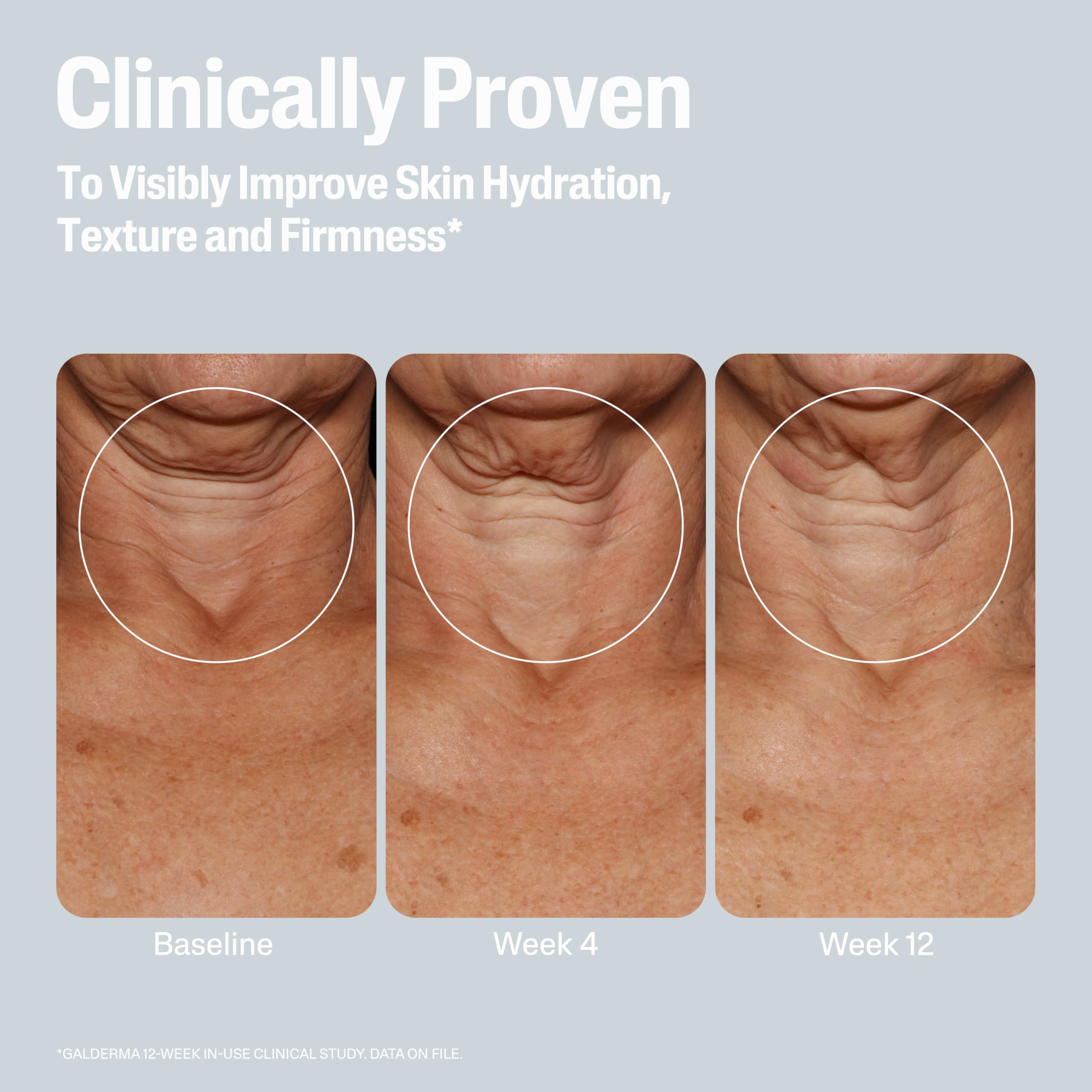 Cetaphil Skin Activator Mandelico: AHA suave para renovación de la piel.