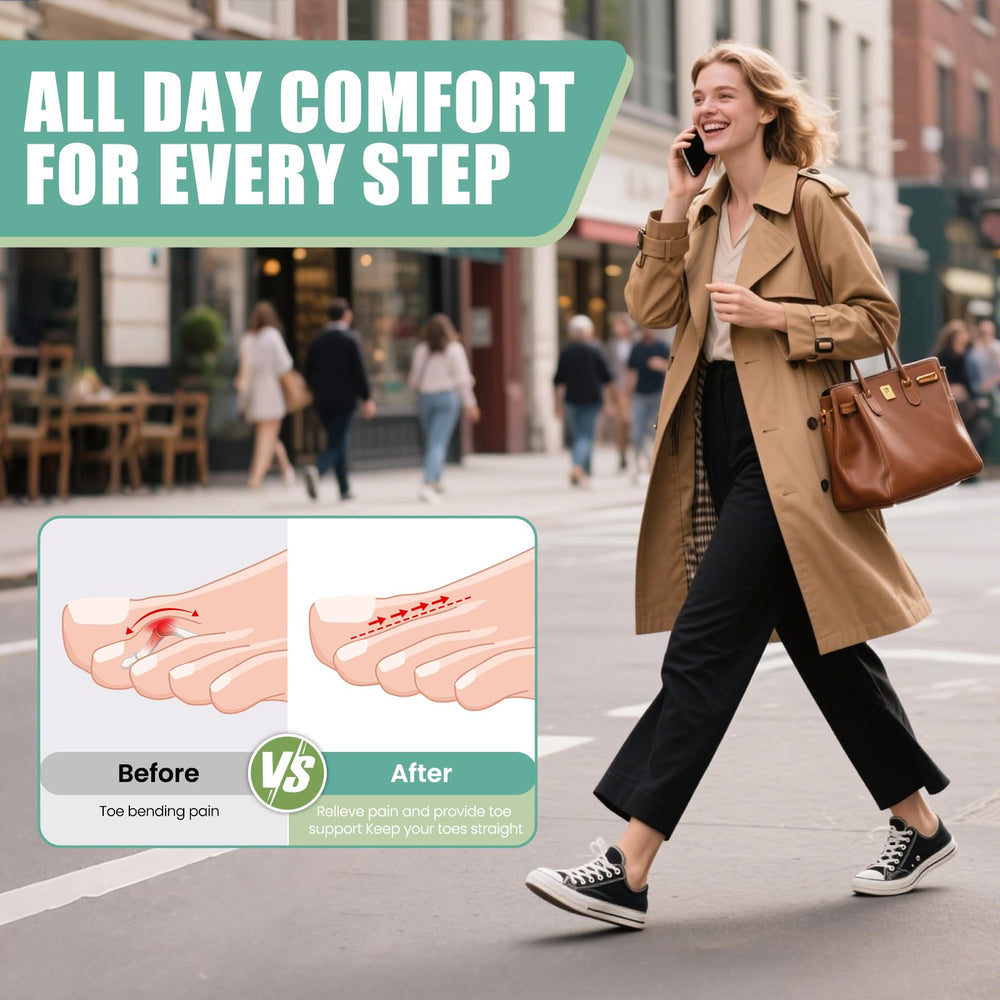 CEYOME aluminum plate toe support detail for stability
