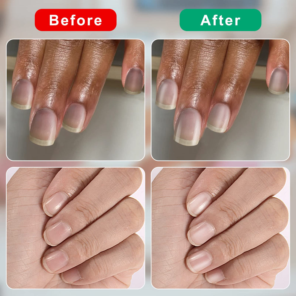 CGBE travel-friendly nail buffer kit for on-the-go touch-ups.