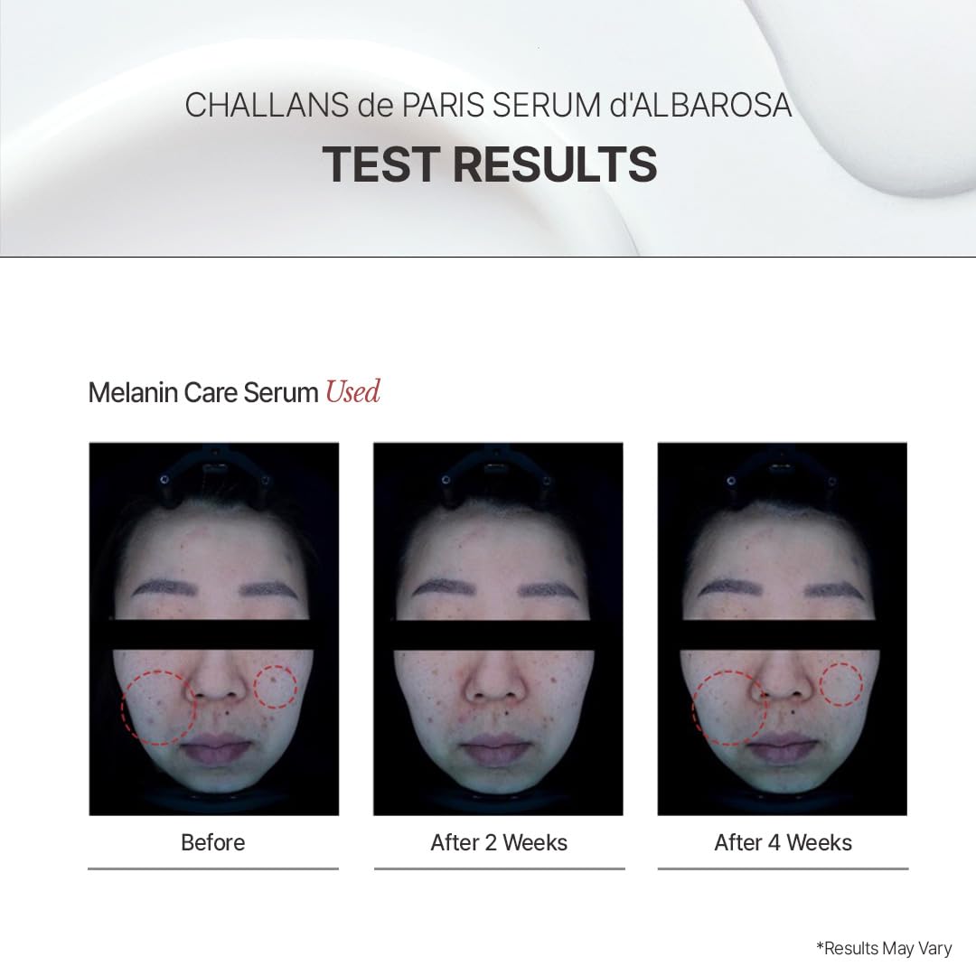 CHALLANS DE PARIS Albarosa ampoule featured in daily routine, Korean-inspired care.