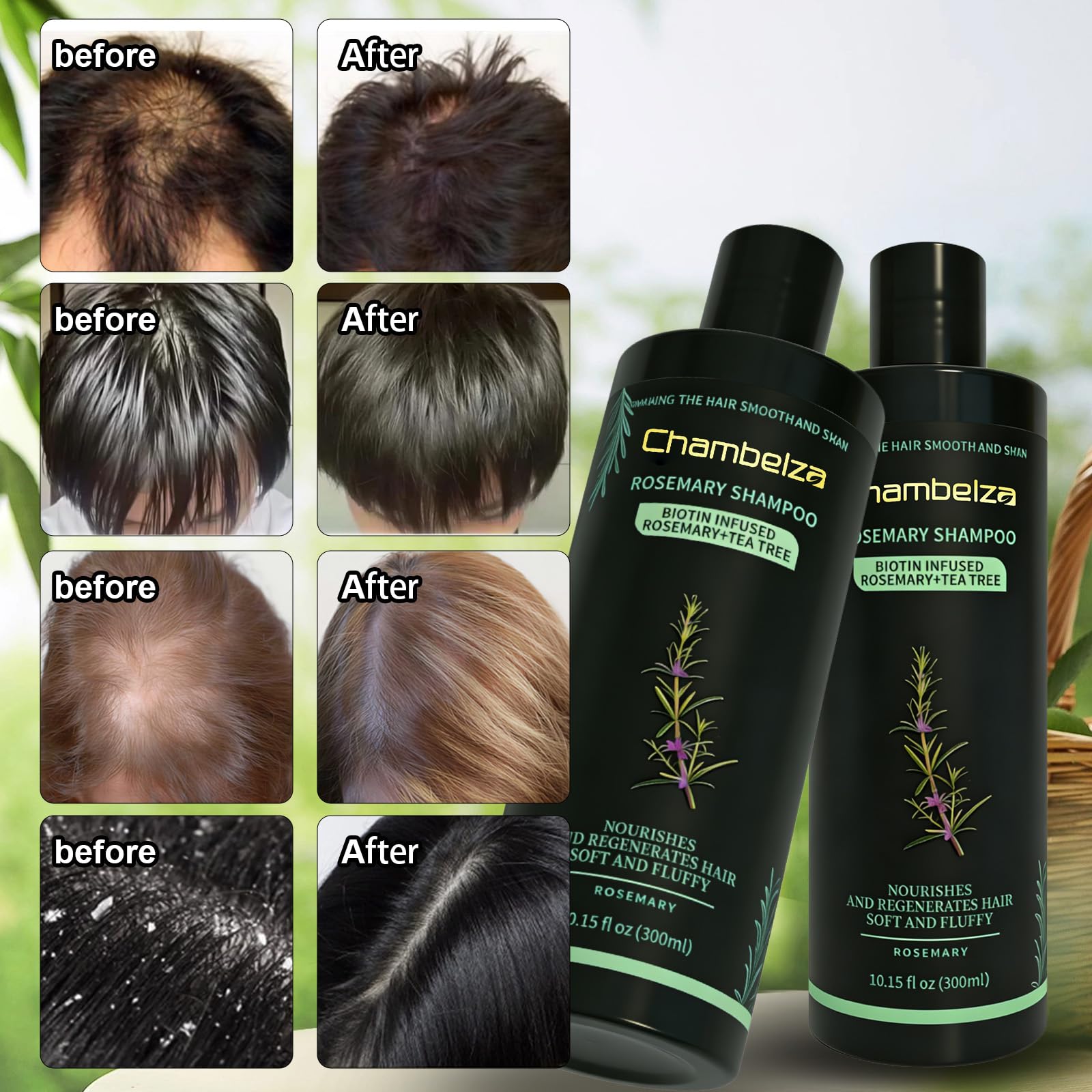 Chambelza Rosemary Shampoo image hints at follicle vitality support.