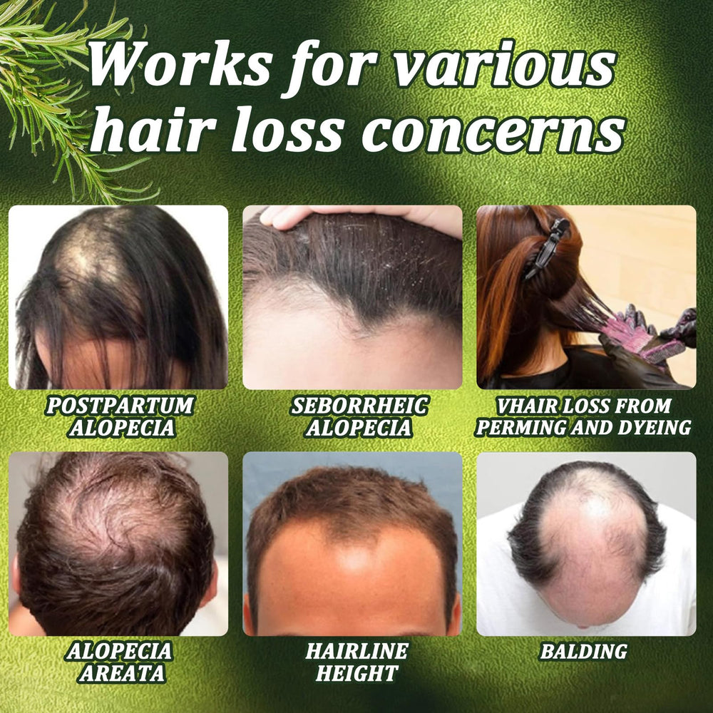 Chambelza Rosemary Shampoo unisex use on both men and women.