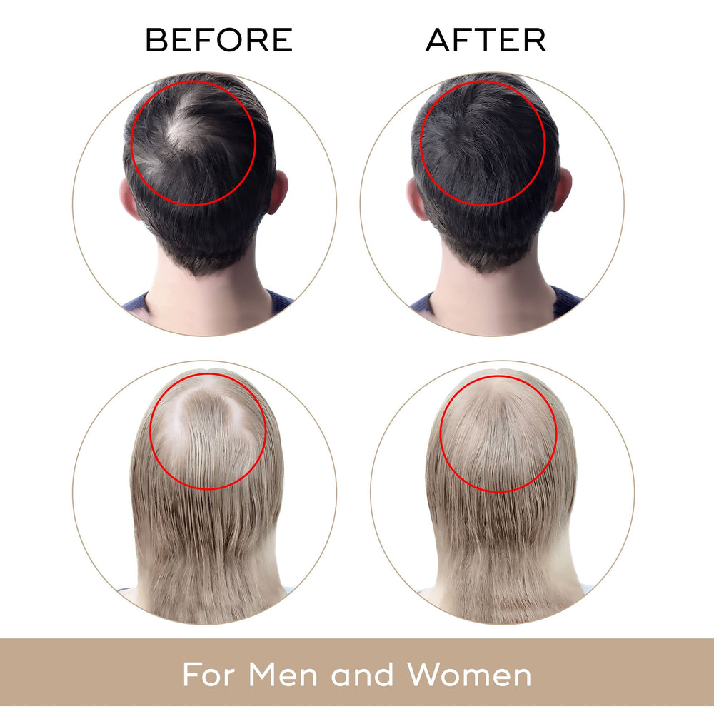 Charismo Dekohair serum dropper application shows mess-free use on thinning areas.