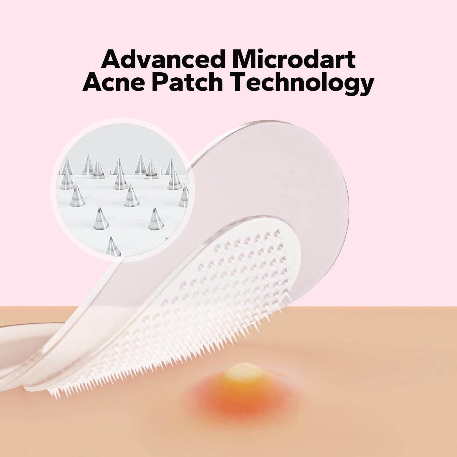 CharmCherry microdart technology delivers actives to the blemish.