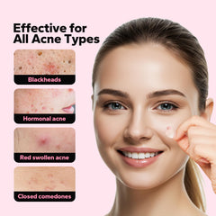 CharmCherry salicylic-acid patch targets pore areas for care.