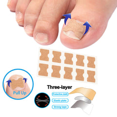 Chemailon breathable ingrown toenail strips ready for daily wear.