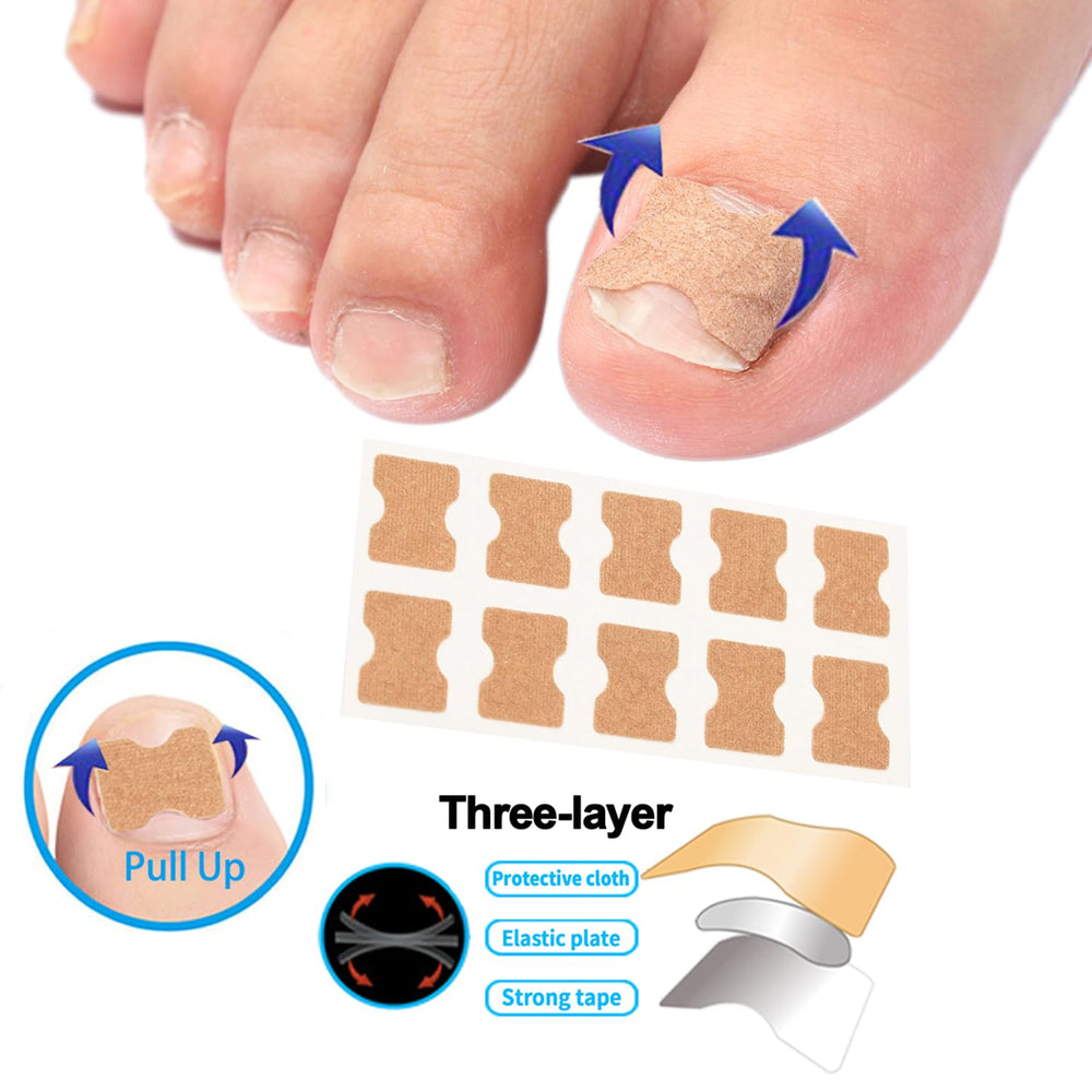 Chemailon care gel soothing redness after nail care.