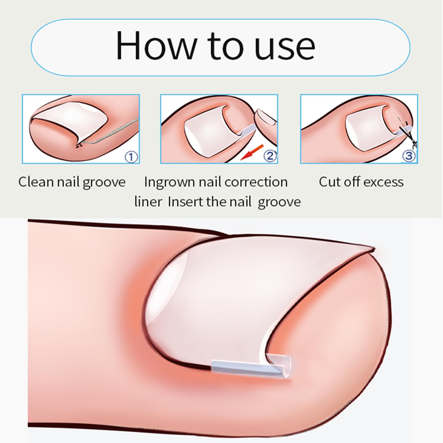 Chemailon ergonomic non-slip handle enables steady trimming.