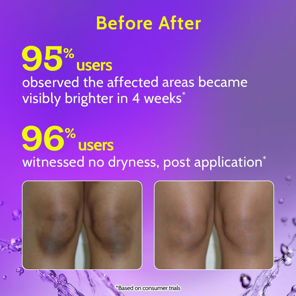 Chemist at Play roll-on applied to skin showing quick absorption