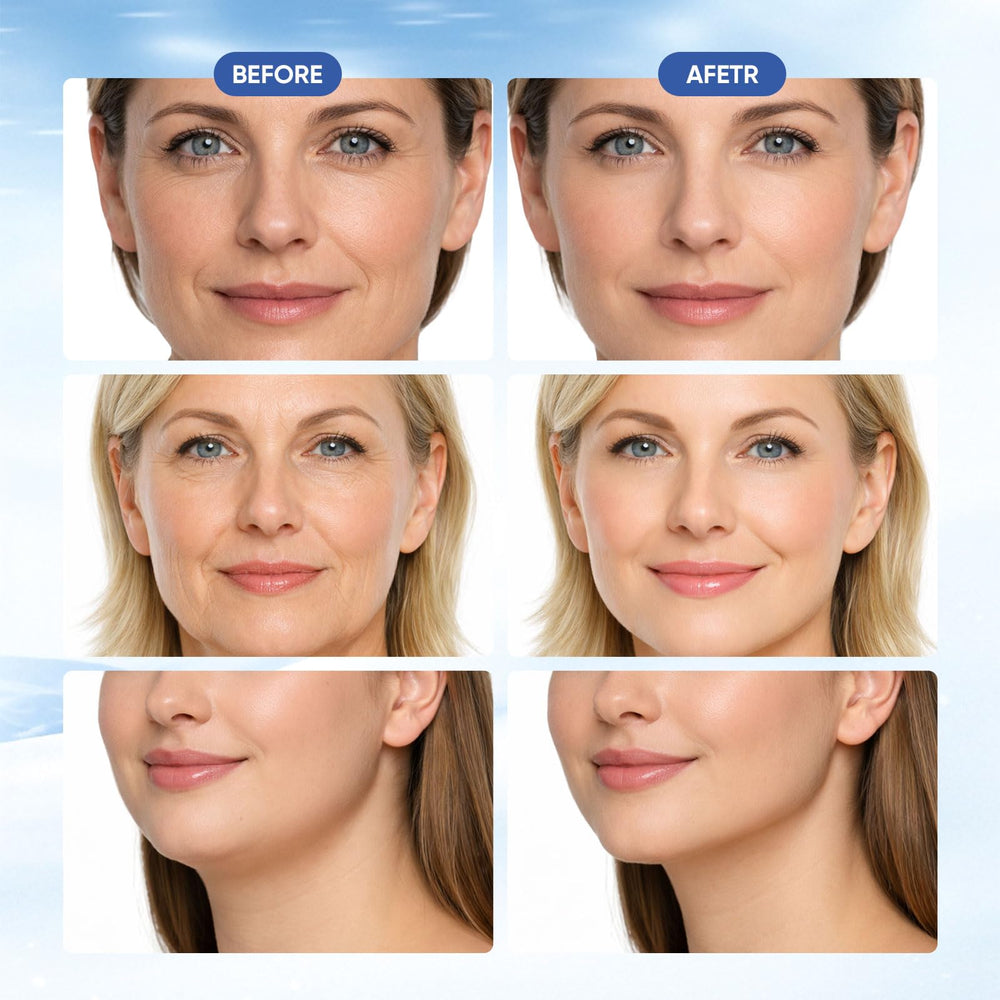 Chinology Double Chin Lifting Mask tightens the jawline for a defined contour.