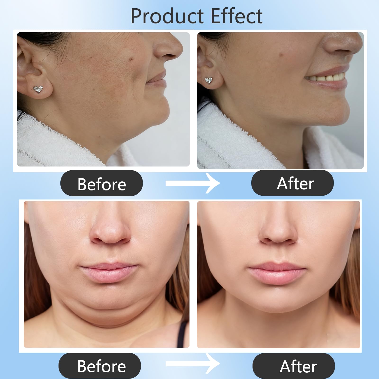 Chinology Double Chin Lifting Mask on face close-up emphasizes gentle texture for all skin types.