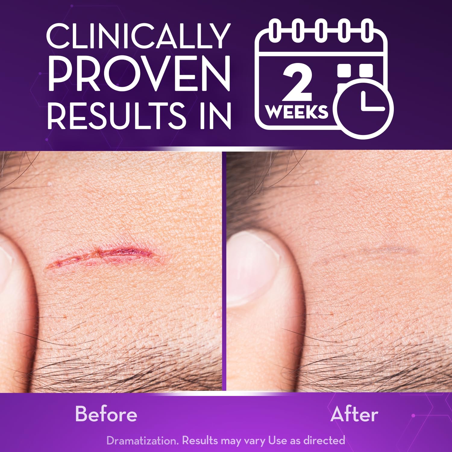 Cicatricure Advanced Scar Gel texture close-up highlights non-greasy absorption.