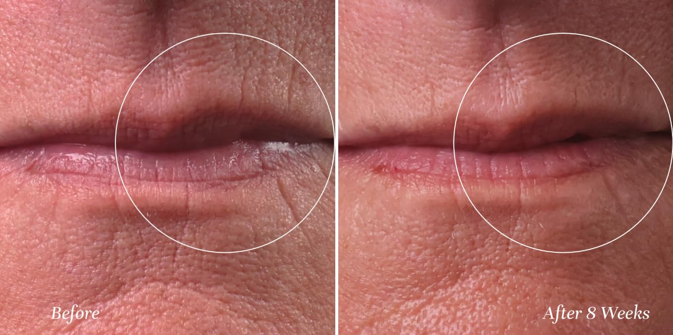 City Beauty City Lips Line Therapy defines and fortifies the lip area.