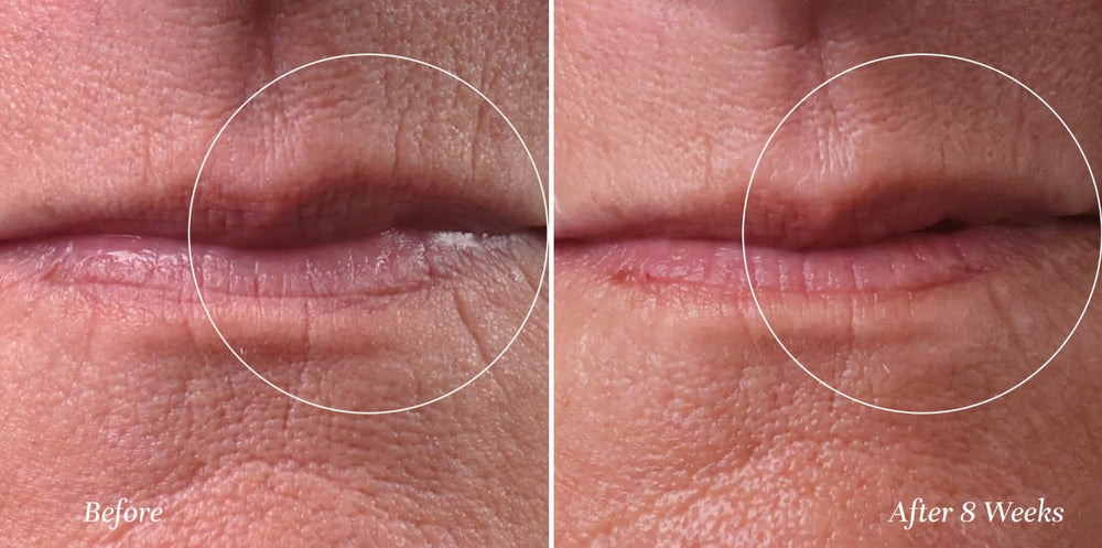 City Beauty City Lips Line Therapy defines and fortifies the lip area.