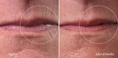 City Beauty City Lips Line Therapy defines and fortifies the lip area.
