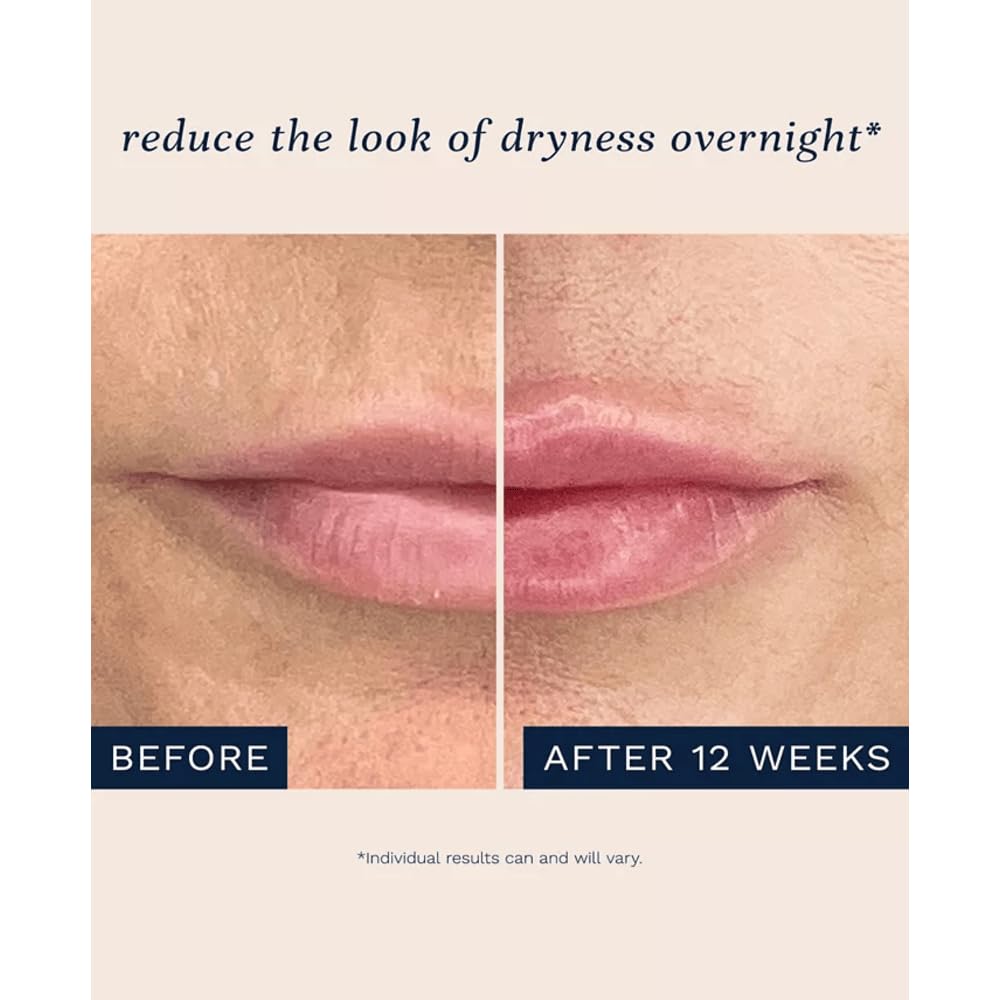 City Beauty City Lips Night Oil application demonstrates easy nightly lip care