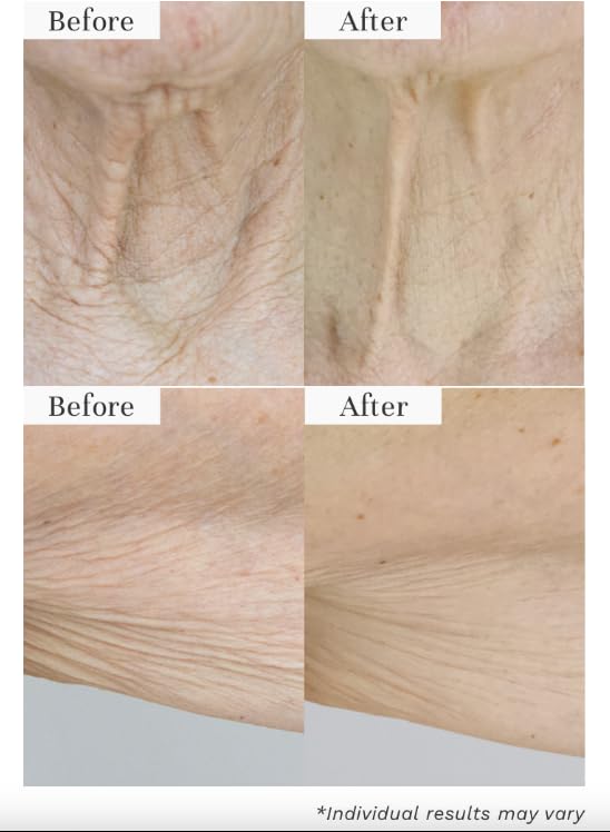 City Beauty InvisiCrepe Balm spread on arm for smoother, firmer look.