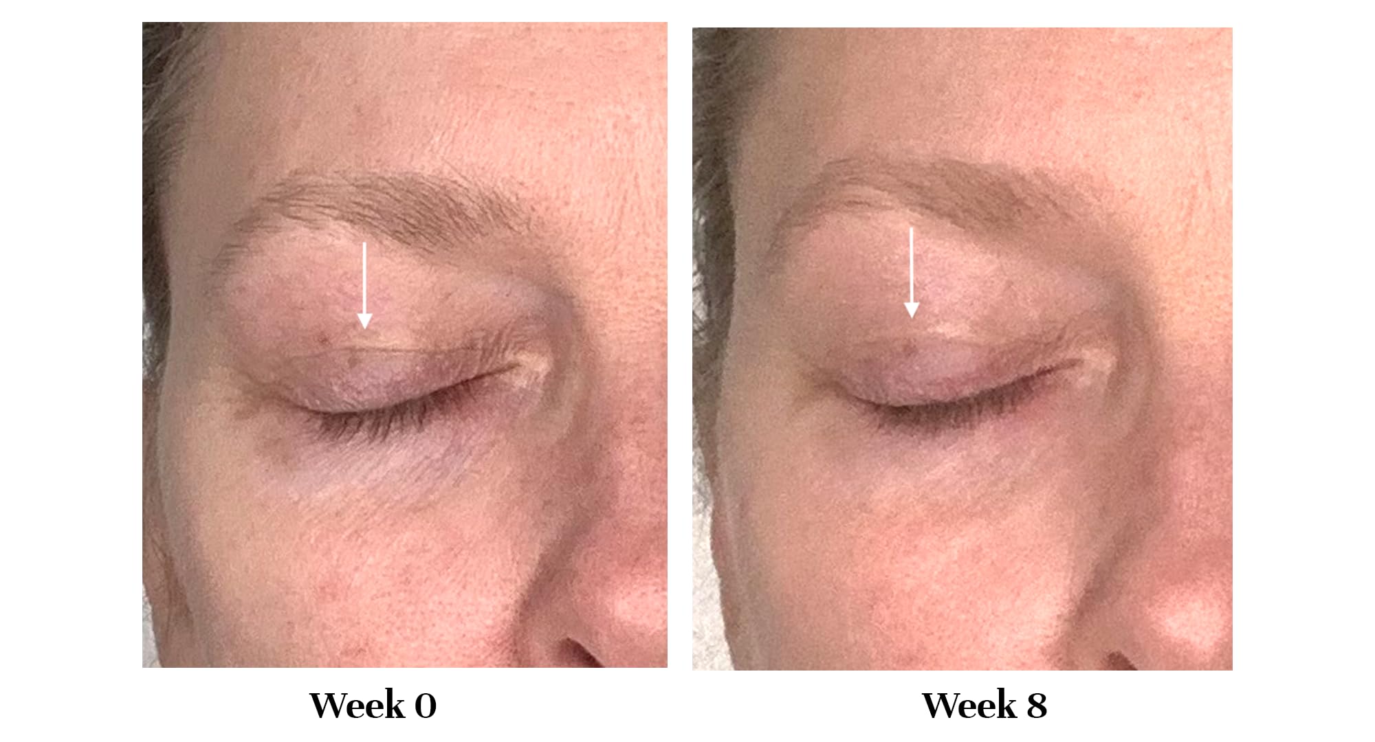 City Beauty Lid Lifting Formula application motion demonstrating light, quick dab for uplift look.