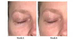 City Beauty Lid Lifting Formula application motion demonstrating light, quick dab for uplift look.