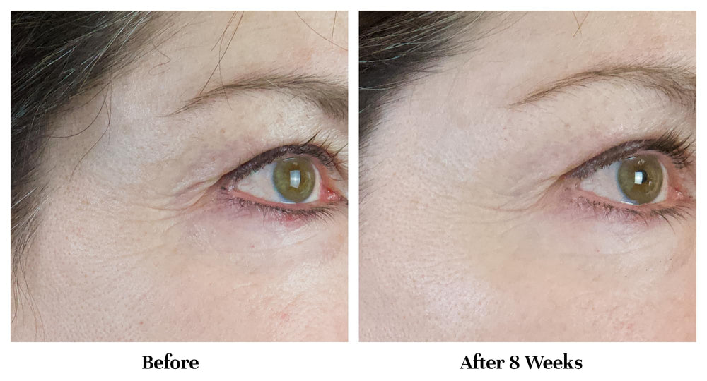City Beauty Line-Blurring Wrinkle Filler soft-focus glow on skin in natural light